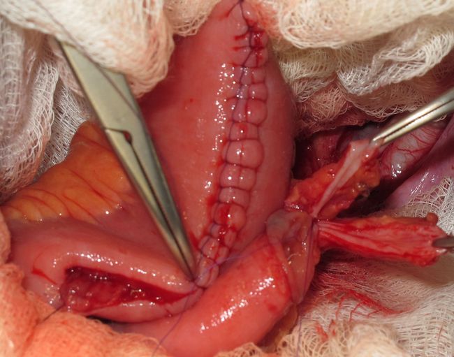 Мочеточнико-резервуарные анастомозы