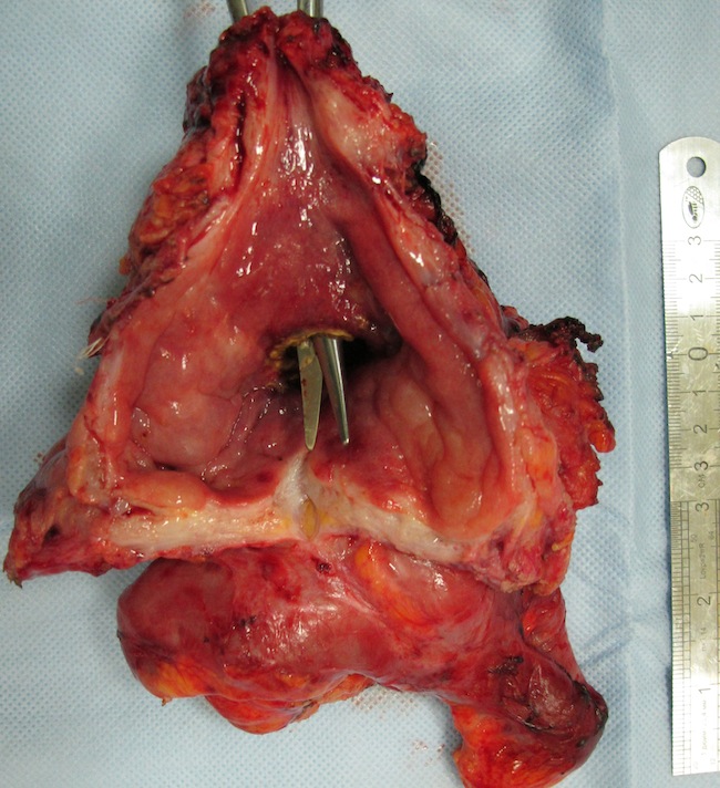 Удаленный органокомплекс