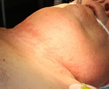 Пациент на операционном столе