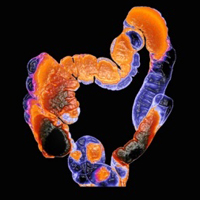 Толсткая кишка и ее заболевания.